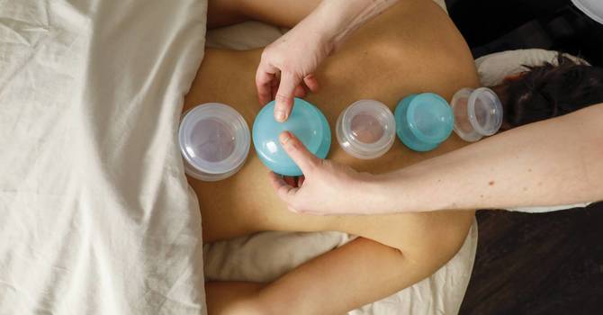 7 Surprising Benefits of Cupping Massage image