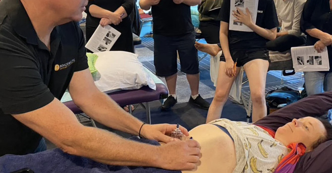 Myofascial Cupping Course image