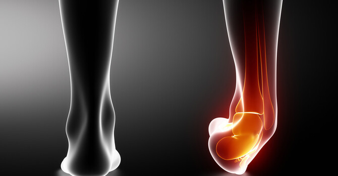 Rethinking Injury Recovery: RICE vs PACE Protocol image