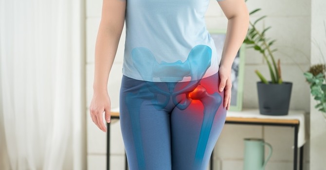 Dealing with Osteoarthritis