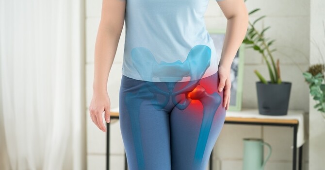 Dealing with Osteoarthritis image